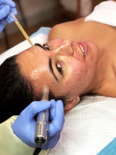 Microneedle 2 for $499